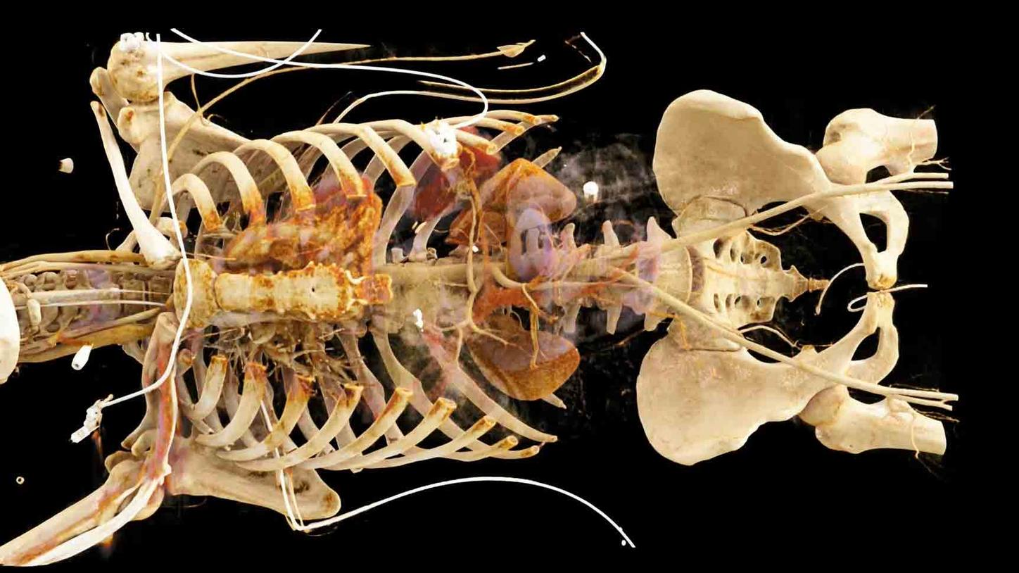 3D anatomical model 