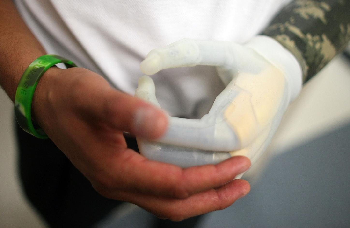 Flexible fingers