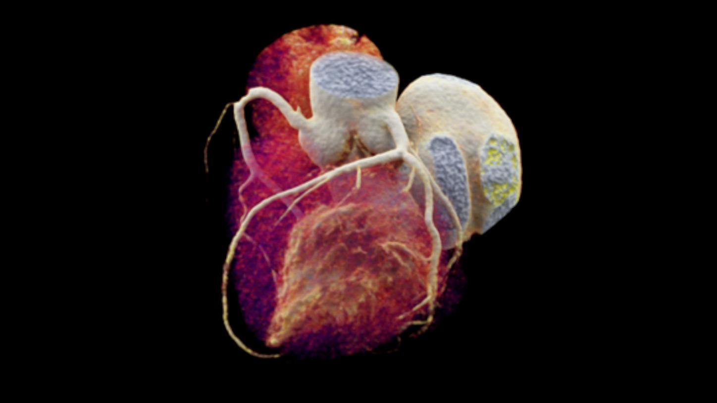 Clinical Specialties Coronary Artery Disease