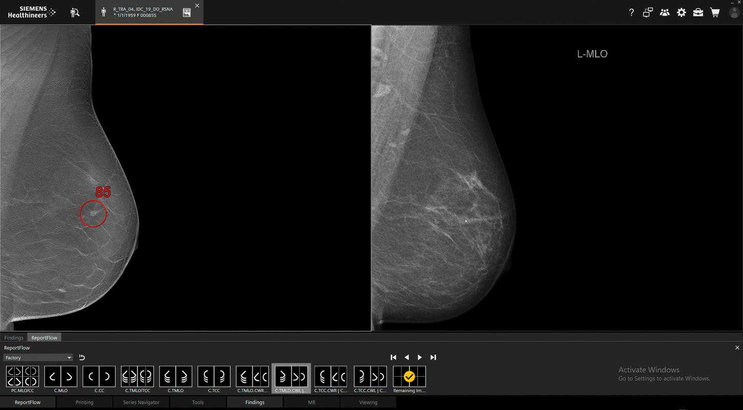 Mammography image