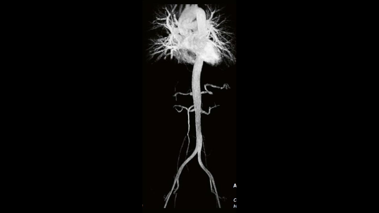 Key investigation areas for MRI are soft tissue areas like brain, abdomen, vessels, ligaments, cartilages or muscles.