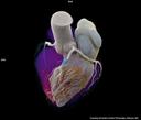 Die photonenzählende Computertomographie liefert den Ärzten zusätzliche Informationen, die Diagnose und Behandlung in Kardiologie, Pulmologie und Onkologie entscheidend verbessern werden.