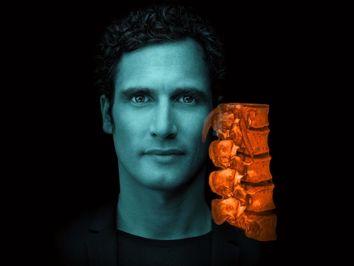 shape experience global spine congress teaser