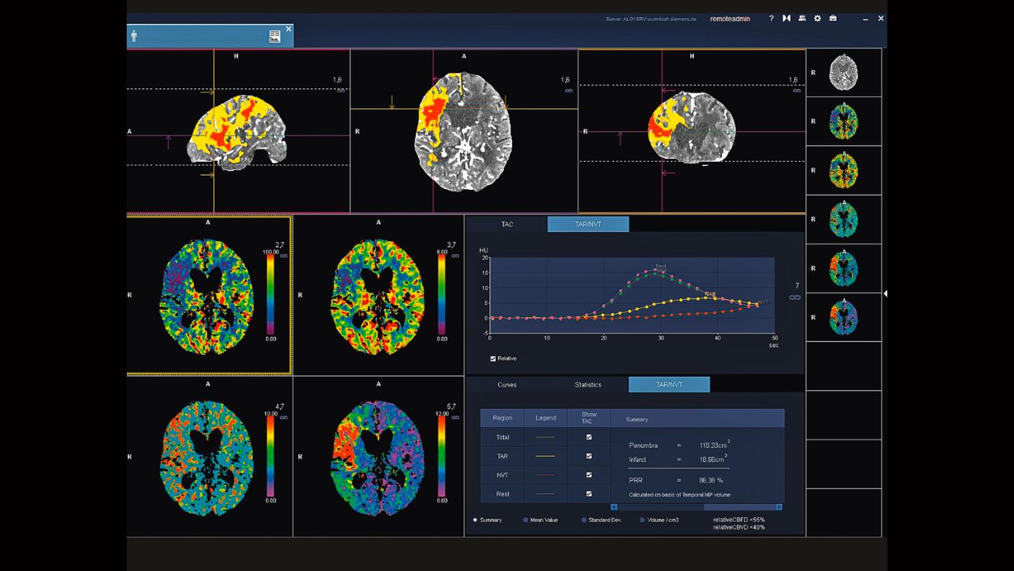CT Neuro Engine