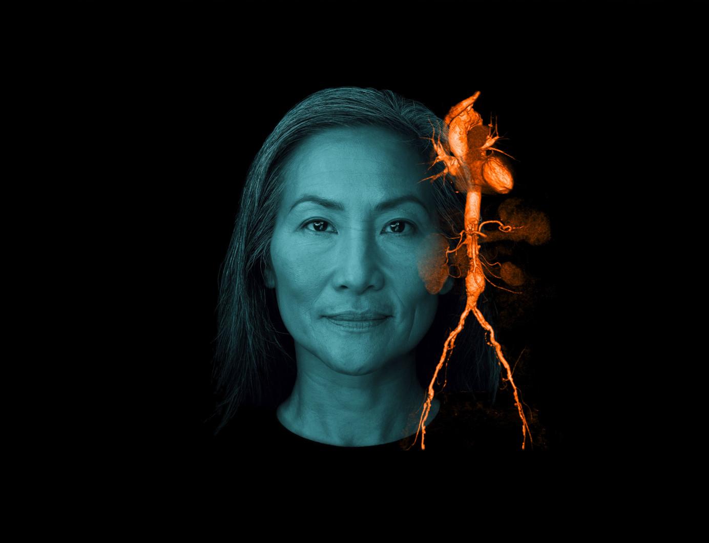 Siemens Healthineers AT Woman Cardiovascular Keyvisual