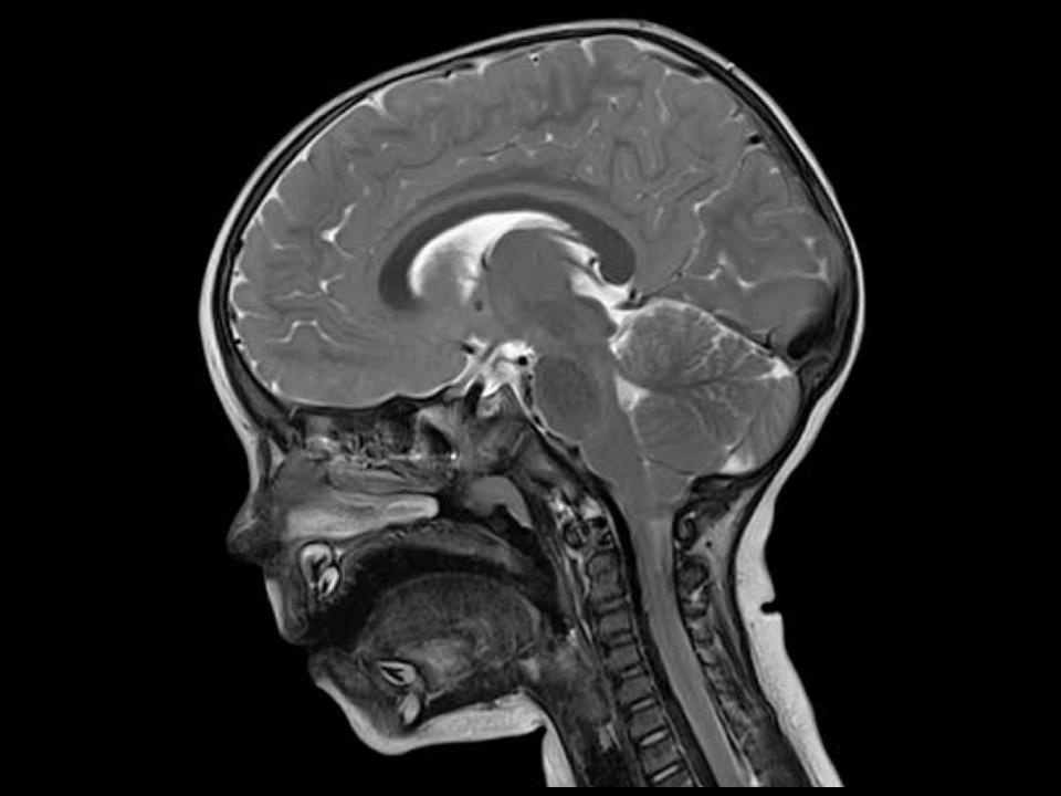 Pediatric MRI