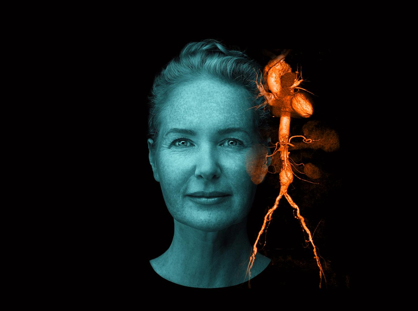Siemens Healthineers AT Woman Marion Cardiovascular Keyvisual