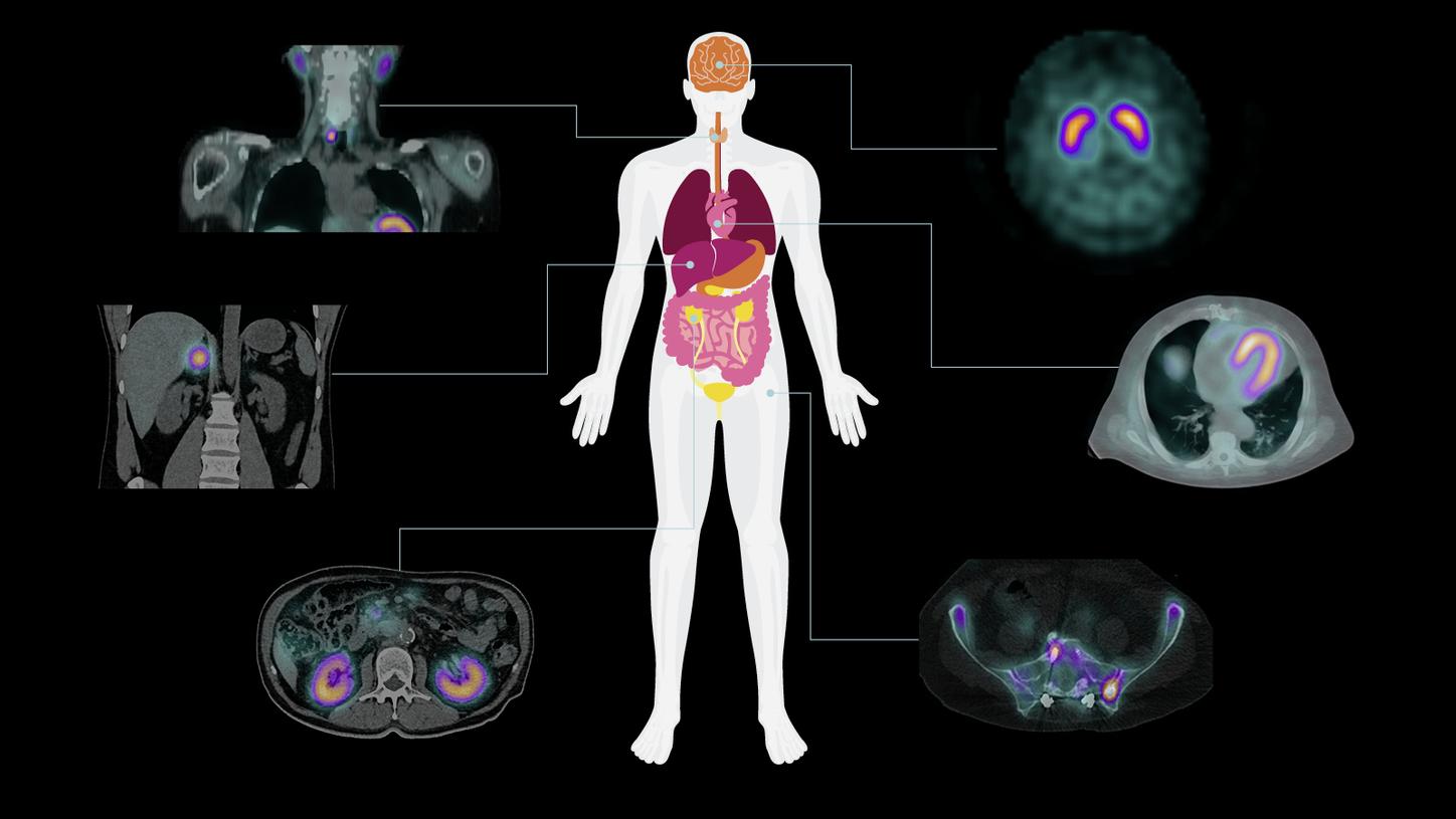 Symbia Pro.specta clinical versatility hero image