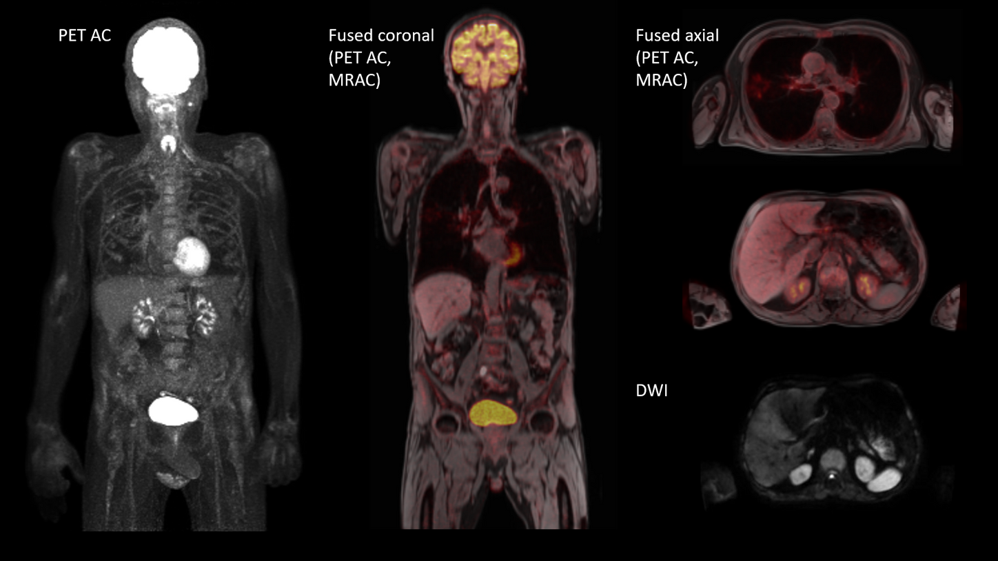 Full body imaging – BIOGRAPH One